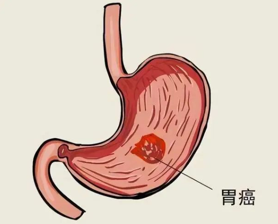 55.png